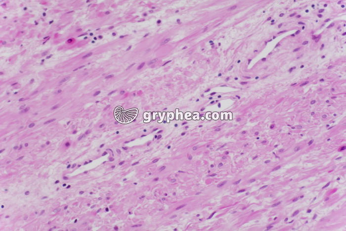 Prostate x100 - gryphea.com